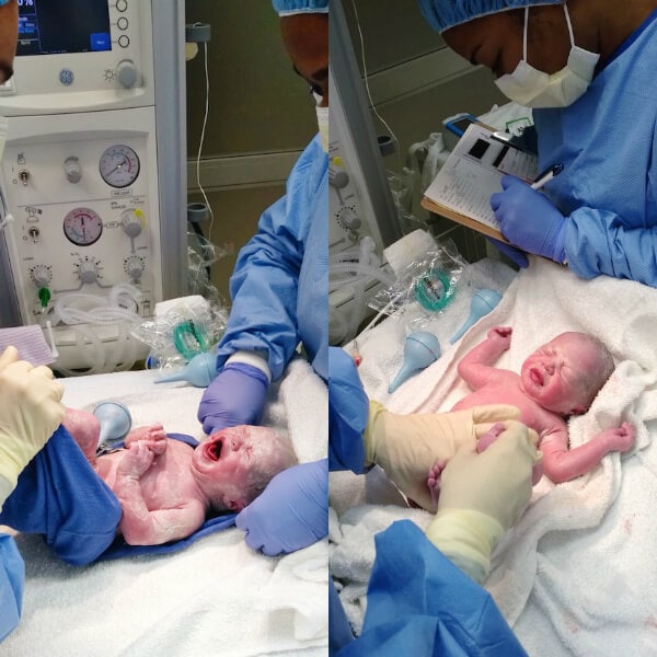 Two Newborns Being Tended to by Doctors Directly Following their Birth